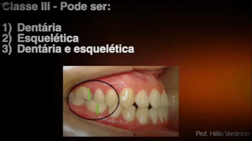 Diagnóstico e origem