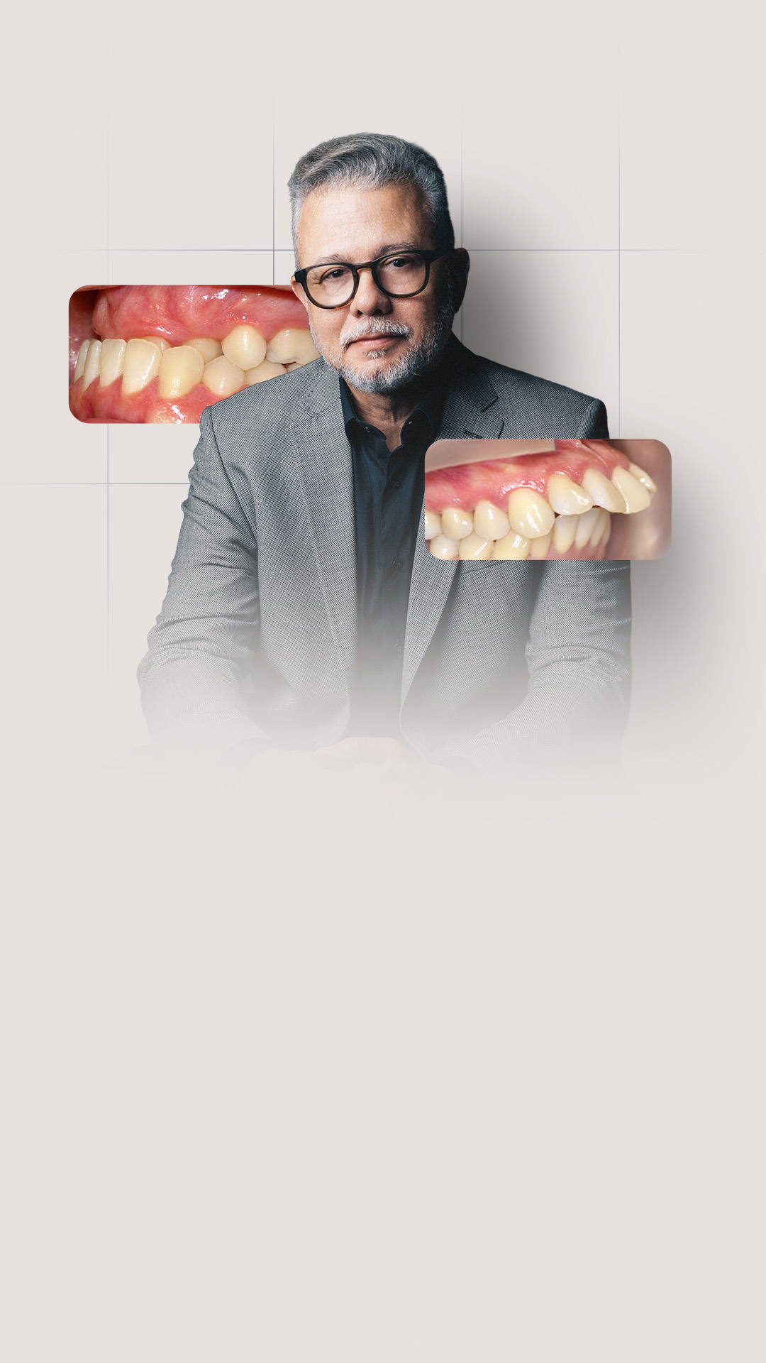 Prof. Hélio Venâncio e casos clínicos de Classe II e III