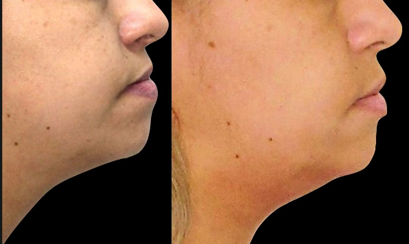 Perfil do paciente antes e depois do tratamento