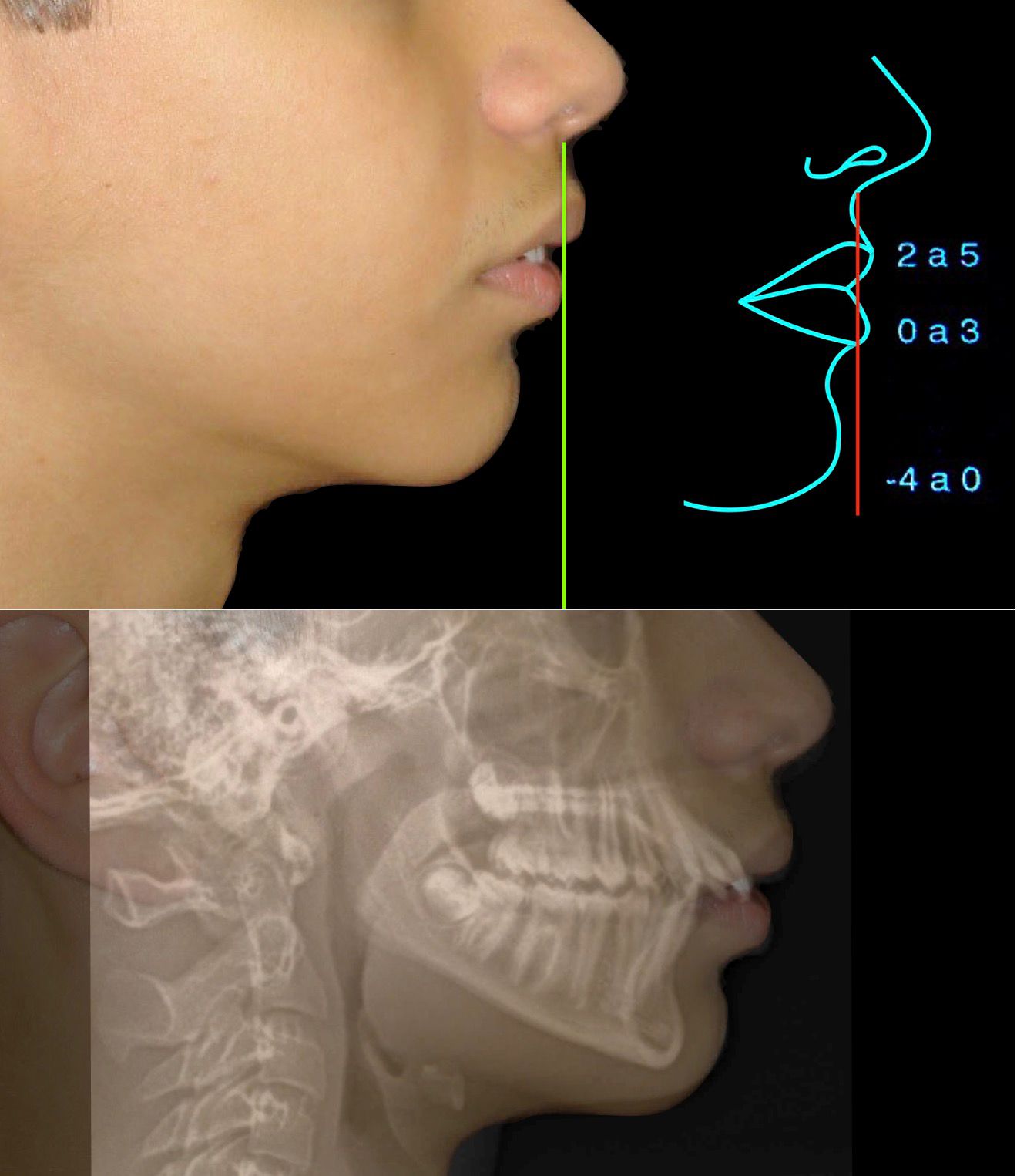 Perfil e telerradiografia do caso